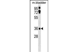 Western blot analysis in mouse bladder tissue lysates (35ug/lane). (EI24 anticorps  (C-Term))