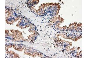 Image no. 5 for anti-Tubulin beta 4a (TUBB4A) antibody (ABIN1501580)