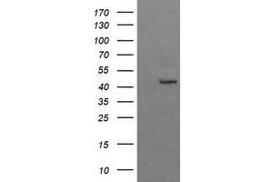 Image no. 1 for anti-butyrobetaine (Gamma), 2-Oxoglutarate Dioxygenase (Gamma-butyrobetaine Hydroxylase) 1 (BBOX1) antibody (ABIN1496816) (BBOX1 anticorps)