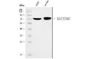 Western blot analysis of BAL/SLC27A5 using anti-BAL/SLC27A5 antibody (ABIN7600576).