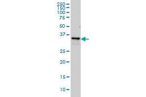 ZWINT monoclonal antibody (M01), clone 6D3 Western Blot analysis of ZWINT expression in Hela S3 NE . (ZWINT anticorps  (AA 1-277))