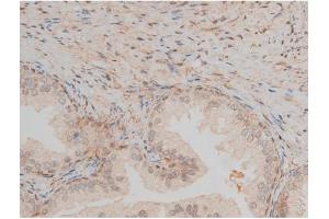 ABIN6267399 at 1/200 staining Human prostate tissue sections by IHC-P. (CREB1 anticorps  (pSer142))