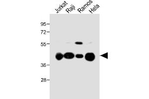 All lanes : Anti-HLA-G Antibody (Center) at 1:1000 dilution Lane 1: Jurkat whole cell lysate Lane 2: Raji whole cell lysate Lane 3: Ramos whole cell lysate Lane 4: Hela whole cell lysate Lysates/proteins at 20 μg per lane.