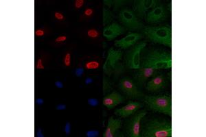 ABIN6257614 and ABIN6275206 staining  cells by IF/ICC. (LRRC41 anticorps  (Internal Region))