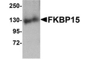 Western Blotting (WB) image for anti-FK506 Binding Protein 15, 133kDa (FKBP15) (N-Term) antibody (ABIN1031380)