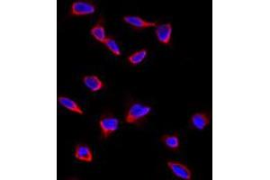 Immunofluorescence analysis of CD9 polyclonal antibody  in HeLa cells. (CD9 anticorps  (Internal Region))