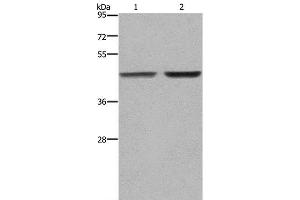 Western Blot analysis of MCF-7 and 231 cell using GABPB2 Polyclonal Antibody at dilution of 1:550 (GABPB2 anticorps)