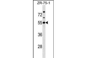 KCNJ1 Antibody (C-term) (ABIN1537138 and ABIN2850385) western blot analysis in ZR-75-1 cell line lysates (35 μg/lane). (KCNJ1 anticorps  (C-Term))