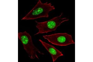 Fluorescent image of NIH/3T3 cells stained with RN Antibody (Center) C. (RNF166 anticorps  (AA 71-97))