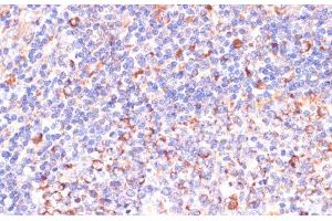 Immunohistochemistry of paraffin-embedded Human tonsil using VHL Polyclonal Antibody at dilution of 1:200 (40x lens). (VHL anticorps)