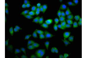 Immunofluorescence staining of Hela cells with ABIN7150346 at 1:100, counter-stained with DAPI. (TOP2B anticorps  (AA 1400-1626))
