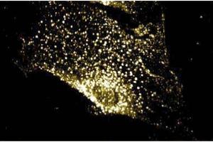 Immunostaining on Human Smooth Muscle