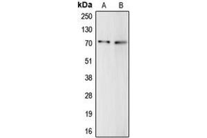 Western blot analysis of Complement C9 expression in HepG2 (A), THP1 (B) whole cell lysates. (C9 anticorps  (Center))