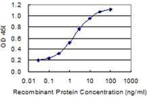 Detection limit for recombinant GST tagged LRGUK is 0. (LRGUK anticorps  (AA 721-825))