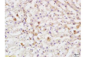 Formalin-fixed and paraffin embedded rat liver labeled with Anti DEPTOR/DEPDC6 Polyclonal Antibody, Unconjugated (ABIN1387597) at 1:200 followed by conjugation to the secondary antibody and DAB staining
