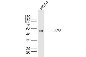 MCF-7 lysates probed with IQCG Polyclonal Antibody, Unconjugated  at 1:300 dilution and 4˚C overnight incubation. (IQCG anticorps)