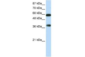 WB Suggested Anti-ARID3B Antibody Titration:  0. (ARID3B anticorps  (C-Term))