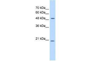 WB Suggested Anti-GCNT4 Antibody Titration:  0. (GCNT4 anticorps  (C-Term))