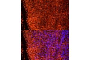 Immunofluorescence analysis of mouse spleen cells using TLR7 Rabbit pAb (ABIN3021246, ABIN3021247, ABIN3021248 and ABIN6214083) at dilution of 1:25 (40x lens).