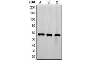 Western blot analysis of TEL expression in CCRFCEM (A), Jurkat (B), K562 (C) whole cell lysates. (ETV6 anticorps  (C-Term))