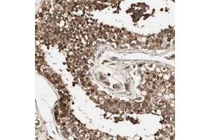 Immunohistochemical staining of human testis with CNOT4 polyclonal antibody  shows strong cytoplasmic positivity in cells of seminiferus ducts. (CNOT4 anticorps)