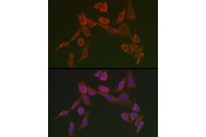 Immunofluorescence analysis of NIH/3T3 cells using HSP47/SERPINH1 Rabbit pAb  at dilution of 1:100 (40x lens). (SERPINH1 anticorps)