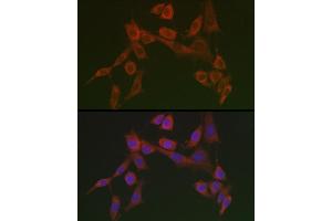 Immunofluorescence analysis of NIH/3T3 cells using HSP47/SERPINH1 Rabbit pAb  at dilution of 1:100 (40x lens). (SERPINH1 anticorps)