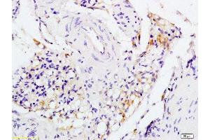 Formalin-fixed and paraffin embedded rat colitis labeled with Anti-IL-1R1/CD121a/IL1 Receptor I Polyclonal Antibody, Unconjugated  at 1:200 followed by conjugation to the secondary antibody and DAB staining.