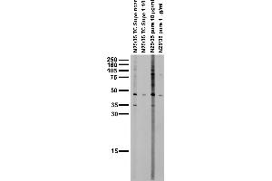 anti-Potassium Inwardly-Rectifying Channel, Subfamily J, Member 4 (KCNJ4) (AA 390-445) antibody