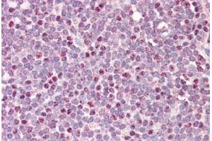 Human Tonsil: Formalin-Fixed, Paraffin-Embedded (FFPE)