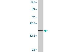 Western Blot detection against Immunogen (32.