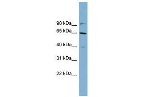 Cytokeratin 84 antibody used at 1 ug/ml to detect target protein. (Keratin 84 anticorps  (Middle Region))