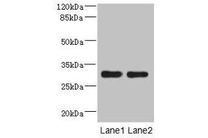 Western blot All lanes: DRAM2 antibody at 3.