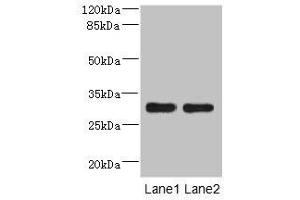 Western blot All lanes: DRAM2 antibody at 3. (DRAM2 anticorps  (AA 182-266))