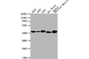 Western Blot Positive WB detected in: A549 whole cell lysate, 293T whole cell lysate, U251 whole cell lysate, Rat Brain tissue, Rabbit Skeletal Muscle tissue All lanes: PKM antibody at 1:1000 Secondary Goat polyclonal to Mouse IgG at 1/10000 dilution Predicted band size: 58 kDa Observed band size: 58 KDa Exposure time: 1 min (PKM anticorps  (AA 2-531))