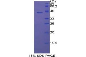 SDS-PAGE analysis of Rat Lipocalin 6 Protein. (LCN6 Protéine)