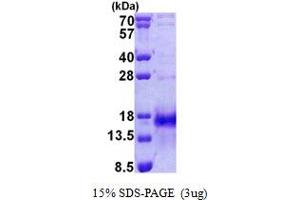 SDS-PAGE (SDS) image for Immediate Early Response 3 (IER3) (AA 1-82) protein (His tag) (ABIN6387207)