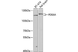 Western blot analysis of extracts of various cell lines, using PDE6A antibody (ABIN6130650, ABIN6145361, ABIN6145362 and ABIN6223910) at 1:1000 dilution. (PDE6A anticorps  (AA 656-860))