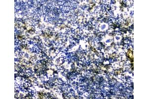 IHC analysis of GLO1 using anti-GLO1 antibody (ABIN5692862).