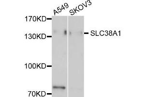 Western blot analysis of extract of A549 and SKOV3 cells, using EMILIN1 antibody. (Emilin1 anticorps)