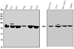 Western blot analysis of Sema6A using anti-Sema6A antibody (ABIN7601261).