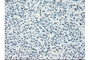 Immunohistochemical staining of paraffin-embedded endometrium tissue using anti-PPP5Cmouse monoclonal antibody.