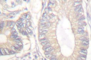 Image no. 1 for anti-Gastrin (GAST) antibody (ABIN265432) (Gastrin anticorps)