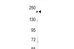 Western blot analysis of COL5A2 Antibody (N-term) (ABIN391537 and ABIN2841488) in mouse lung tissue lysates (35 μg/lane).
