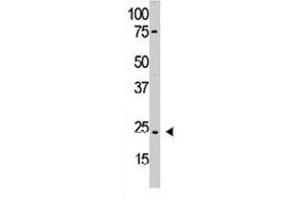 The PDGFA polyclonal antibody  is used in Western blot to detect PDGFA in HL-60 cell lysate. (PDGFA anticorps  (N-Term))
