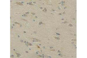 Used in DAB staining on fromalin fixed paraffin- embedded Kidney tissue