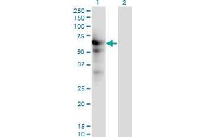 Western Blot analysis of USP14 expression in transfected 293T cell line by USP14 monoclonal antibody (M04), clone 6D6.