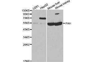 Western blot analysis of extracts of various cell lines, using PAH antibody. (Phenylalanine Hydroxylase anticorps  (AA 1-290))
