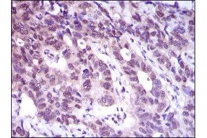 Immunohistochemistry (IHC) image for anti-ATP Citrate Lyase (ACLY) (AA 306-502) antibody (ABIN1842880)