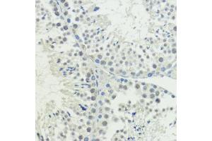 Immunohistochemistry of paraffin-embedded mouse testis using BA antibody (ABIN7265937) at dilution of 1:200 (40x lens). (BAZ2A anticorps)